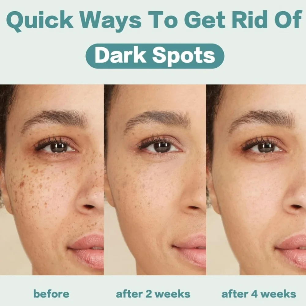 🌿NWT 💚CITYGOO: Dark Spot Corrector Cream - ⭐️Enriching Skin Cream✨️